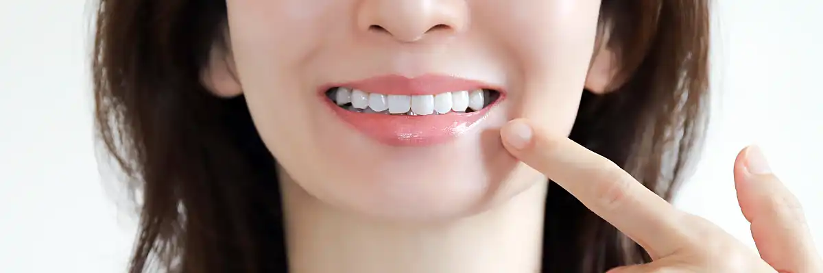 虫歯予防：美しい歯を守る